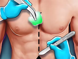 Abdominal Surgery